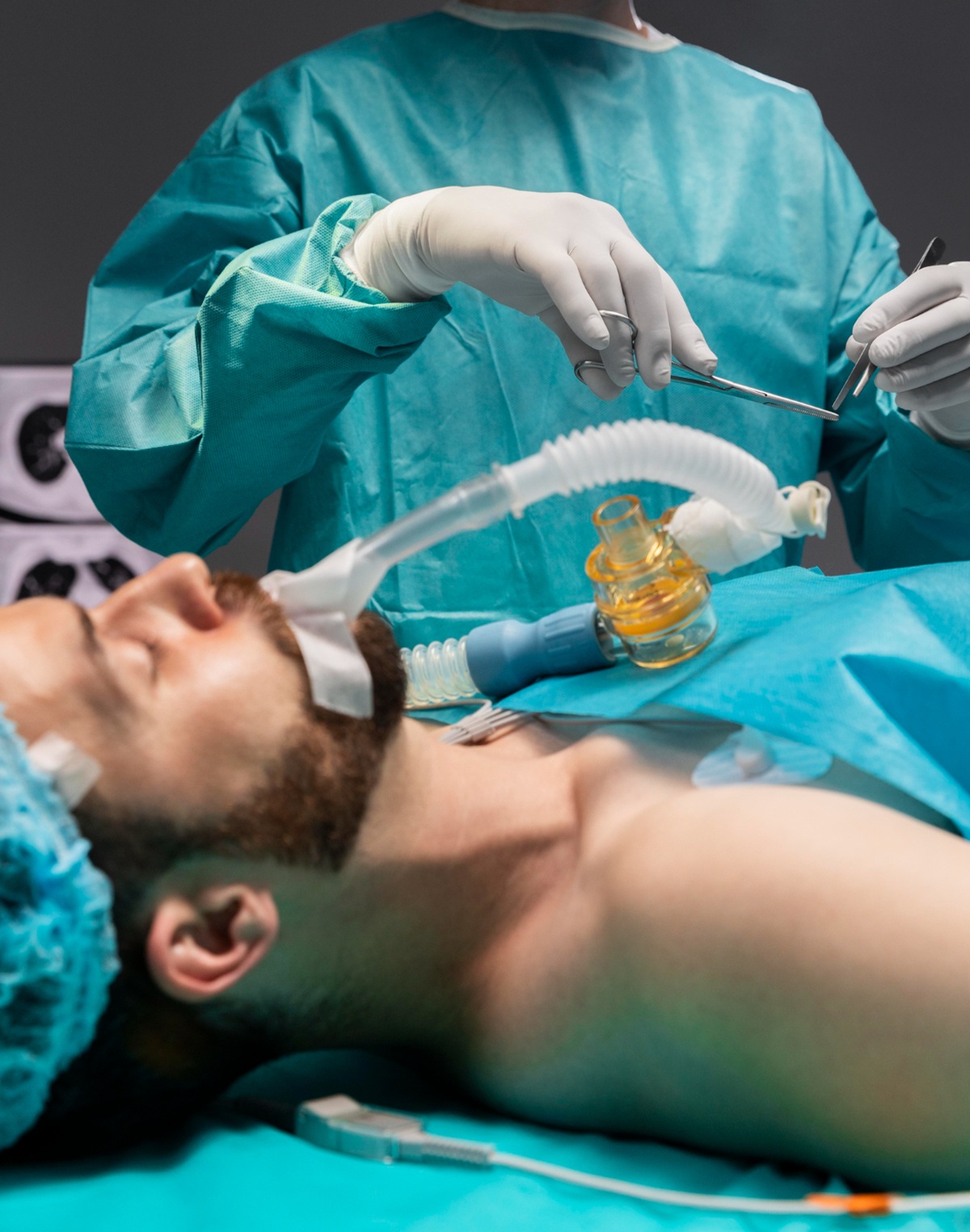 Paciente deitado em mesa de cirurgia, com tubo e equipamentos médicos para intubação